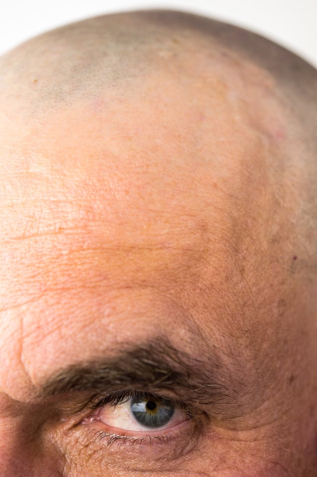 Verm-bald-eye-soft-n-nat-3165 Verm-bald-eye-soft-n-nat-3165