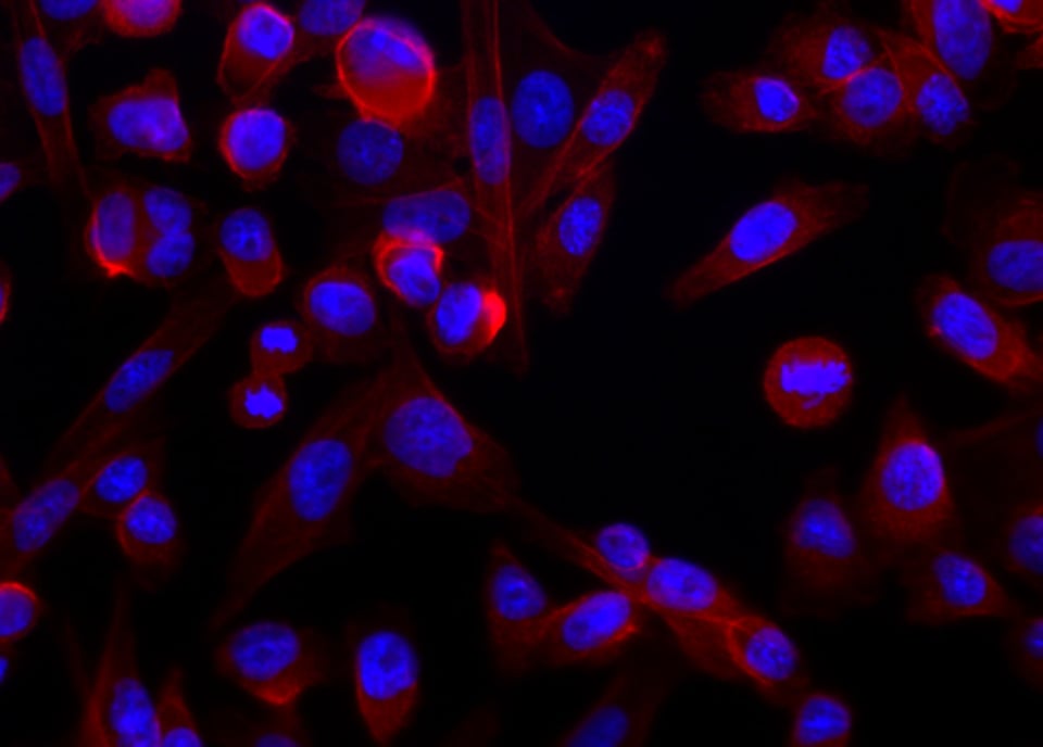 mcc_01_hoechst_phalloidin