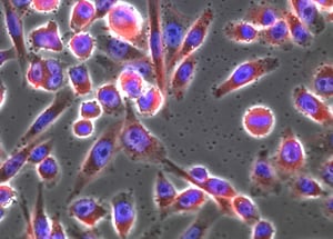 mcc_lead_phase_hoechst_phalloidin