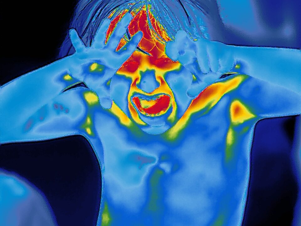 Tereza_Thermal Image_10